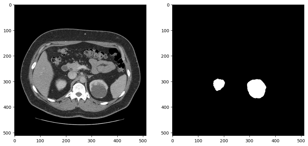 ../_images/ct-segmentation-quantize-nncf-with-output_14_1.png