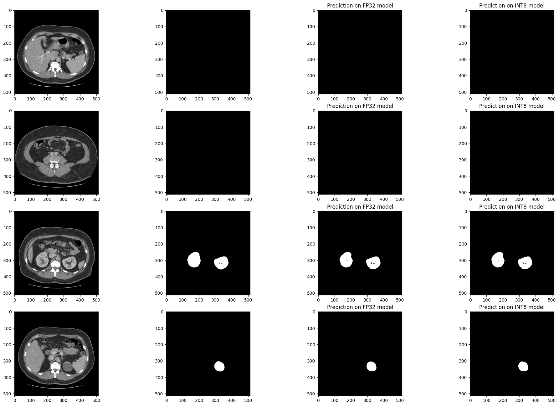 ../_images/ct-segmentation-quantize-nncf-with-output_37_1.png