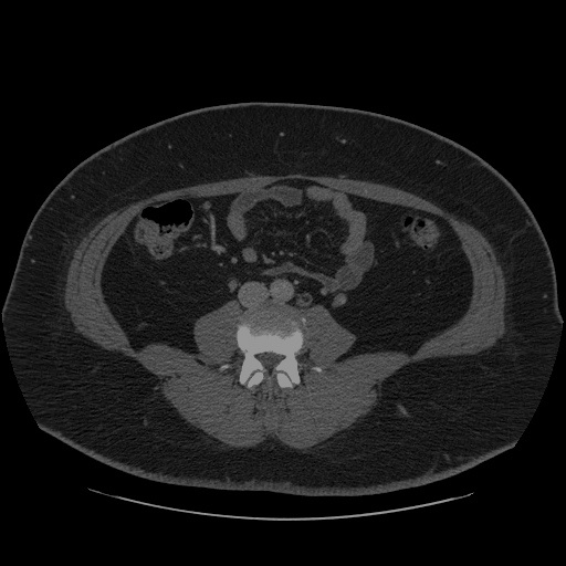 ../_images/ct-segmentation-quantize-nncf-with-output_42_0.jpg